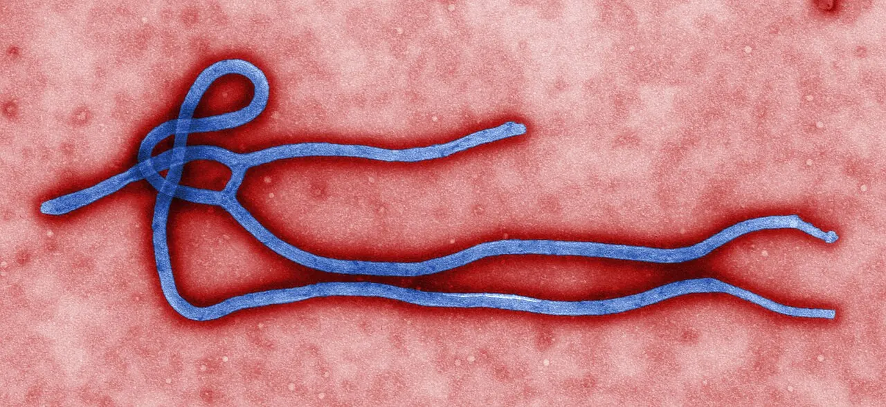 Nigeria Confirms Ebola Case in Abuja, Traces 44 Contacts
