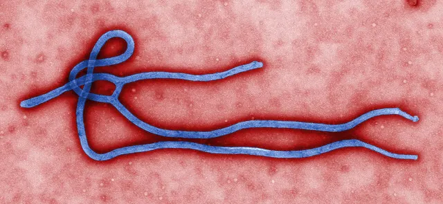 Ebola: Abuja Patient Recovering as Tests Link Virus Closely to Kenya Case